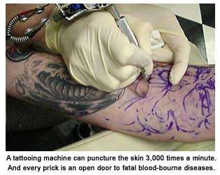 Tattoo Procedures